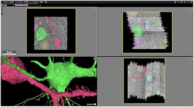 Igneous: Distributed dense 3D segmentation meshing, neuron skeletonization, and hierarchical downsampling